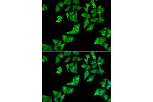 Immunofluorescence analysis of HeLa cell using AGA antibody. (AGA antibody)