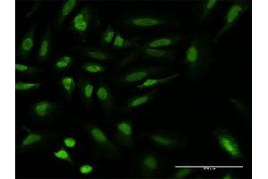 Immunofluorescence of monoclonal antibody to UBR1 on HeLa cell.