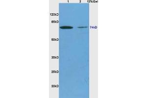 Lane 1: mouse brain lysates Lane 2: mouse heart lysates probed with Anti ALOX15B/15 Lipoxygenase 2 Polyclonal Antibody, Unconjugated (ABIN873138) at 1:200 in 4 °C. (ALOX15B antibody  (AA 13-110))