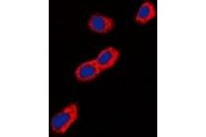 Immunofluorescent analysis of GIP Receptor staining in A549 cells. (GIPR antibody)
