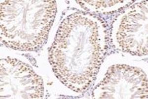 Immunohistochemistry analysis of paraffin-embedded mouse testis using,NUDT22 (ABIN7074928) at dilution of 1: 7200