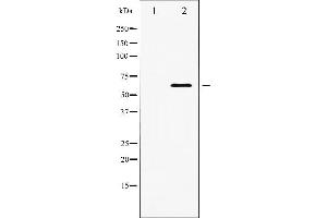 Western blot analysis of PDK1 expression in EGF treated MDA-MB-435 whole cell lysates,The lane on the left is treated with the antigen-specific peptide. (PDPK1 antibody  (Internal Region))