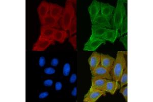 ABIN6256606 and ABIN6268850 staining Hela cells(30 min of UV treatment) by IF/ICC. (DCT antibody  (N-Term))