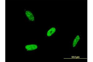 Immunofluorescence of monoclonal antibody to RBMS2 on HeLa cell.