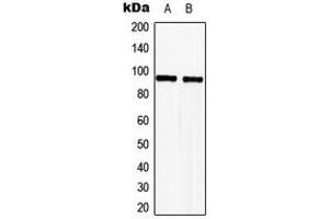 Western blot analysis of TLE2 expression in HeLa (A), Jurkat (B) whole cell lysates.