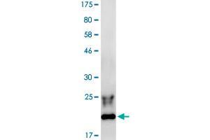 Western Blotting (WB) image for Ectodysplasin A (EDA) (AA 245-389) protein (His-DYKDDDDK-Strep II Tag) (ABIN4369864)