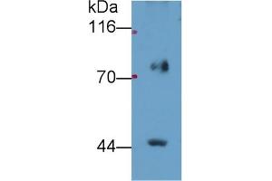 Detection of FADS2 in Porcine Lung lysate using Polyclonal Antibody to Fatty Acid Desaturase 2 (FADS2) (FADS2 antibody  (AA 1-130))