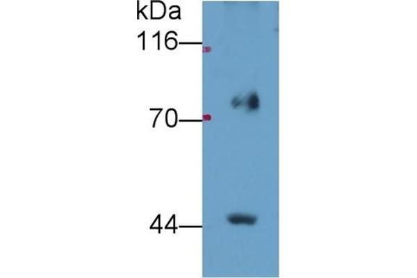 FADS2 antibody  (AA 1-130)