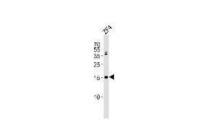 Anti-gabarapl2 Antibody (N-term) at 1:2000 dilution + ZF4 whole cell lysates Lysates/proteins at 20 μg per lane. (GABARAPL2 antibody  (N-Term))