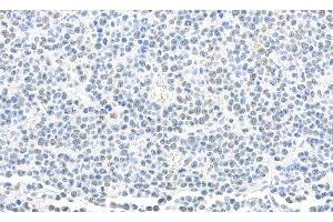 anti-SET Nuclear Oncogene (SET) (AA 125-175) antibody