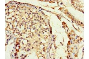 Immunohistochemistry of paraffin-embedded human testis tissue using ABIN7155679 at dilution of 1:100 (DLX5 antibody  (AA 1-249))