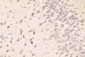Immunohistochemistry analysis of paraffin-embedded mouse striatum using,TTL (ABIN7076048) at dilution of 1: 4000 (TTL antibody)
