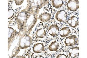 IHC analysis of ITCH/AIP4 using anti-ITCH/AIP4 antibody (ABIN7600264). (ITCH antibody  (AA 17-358))