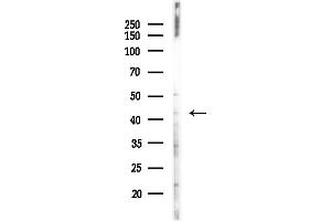 anti-Sarcoglycan, alpha (50kDa Dystrophin-Associated Glycoprotein) (SGCA) (Internal Region) antibody
