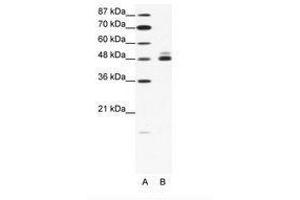 Image no. 1 for anti-Cholinergic Receptor, Nicotinic, beta 2 (Neuronal) (CHRNB2) (AA 21-70) antibody (ABIN202670)