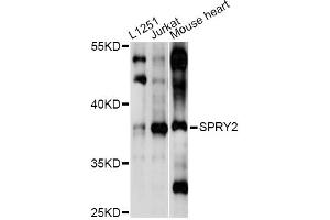 Western blot analysis of extracts of various cell lines, using SPRY2 antibody (ABIN6293587) at 1:1000 dilution. (SPRY2 antibody)