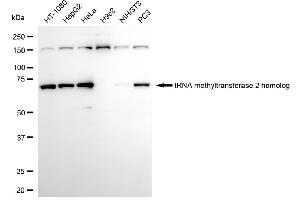 Western blotting analysis using tRNA methyltransferase 2 homolog antibody (ABIN7800983).
