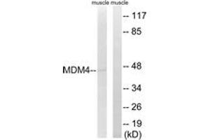 Western blot analysis of extracts from rat muscle cells, using MDM4 (Ab-367) Antibody.