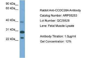 WB Suggested Anti-CCDC28A  Antibody Titration: 0. (CCDC28A antibody  (Middle Region))