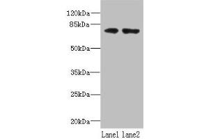 Western blot All lanes: WDTC1 antibody at 1. (WDTC1 antibody  (AA 201-420))