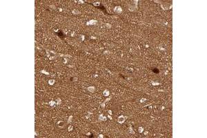 Immunohistochemical staining of human cerebral cortex with SDCCAG1 polyclonal antibody  shows strong nuclear and cytoplasmic positivity in neuronal cells. (NEMF antibody)