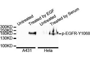 Western blot analysis of extracts of various cell lines, using Phospho-EGFR-Y1068 antibody. (EGFR antibody  (pTyr1092))