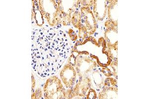 Immunohistochemical analysis of paraffin-embedded H. (BIM antibody  (AA 134-160))