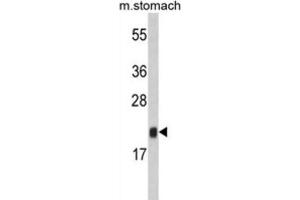 Western Blotting (WB) image for anti-FK506 Binding Protein 11, 19 KDa (FKBP11) antibody (ABIN3002801)