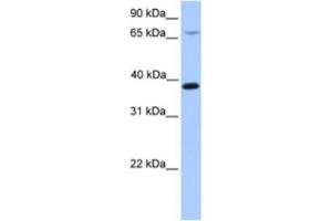 Western Blotting (WB) image for anti-Hydroxymethylbilane Synthase (HMBS) antibody (ABIN2463631) (HMBS antibody)