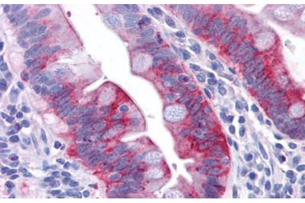 GPR31 antibody  (Extracellular Domain)