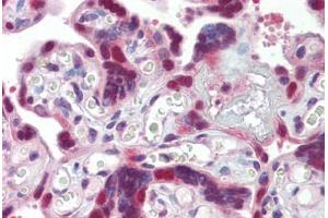 Placenta, Human: Formalin-Fixed, Paraffin-Embedded (FFPE) (DNAJB1 antibody)