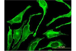Immunofluorescence of monoclonal antibody to GALNT1 on HeLa cell. (Galnt1 antibody  (AA 42-123))