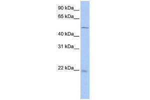 WB Suggested Anti-SDCBP2 Antibody Titration: 0. (SDCBP2 antibody  (N-Term))