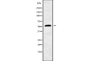 Western blot analysis of RASGEF1A using COLO205 whole cell lysates (RASGEF1A antibody  (Internal Region))