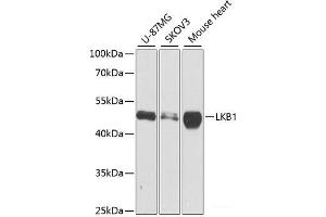 Western blot analysis of extracts of various cell lines using LKB1 Polyclonal Antibody at dilution of 1:1000. (LKB1 antibody)