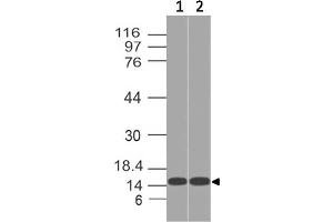 Image no. 1 for anti-Acyl-CoA Thioesterase 13 (ACOT13) antibody (ABIN5027794) (THEM2 antibody)