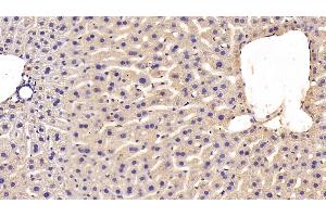 Detection of MT2 in Mouse Liver Tissue using Polyclonal Antibody to Metallothionein 2 (MT2) (MT2 antibody  (AA 2-61))