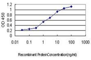Detection limit for recombinant GST tagged N4BP2 is approximately 0. (N4BP2 antibody  (AA 1671-1770))