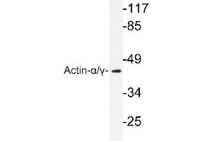 Image no. 2 for anti-Actin (pan) antibody (ABIN271986)