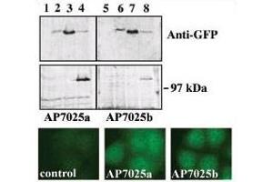 Upper panel, western blot analysis of GFP fusion protein expression in Panc-1 cells by using an anti-GFP antibody. (PRKD3 antibody  (C-Term))