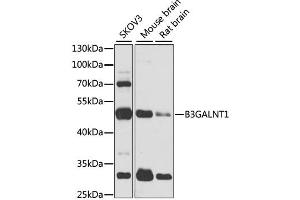 Western blot analysis of extracts of various cell lines, using B3GALNT1 antibody (ABIN2736338) at 1:1000 dilution. (B3GALNT1 antibody)