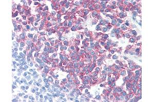 Anti-PAG1 / PAG antibody IHC of human tonsil. (PAG1 antibody  (C-Term))