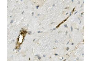 IHC analysis of MSN using anti-MSN antibody (ABIN7600378).