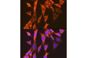 Immunofluorescence (IF) image for anti-Eukaryotic Translation Elongation Factor 2 (EEF2) antibody (ABIN7267025)