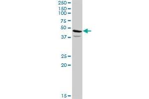 ACAT2 MaxPab rabbit polyclonal antibody. (ACAT2 antibody  (AA 1-397))
