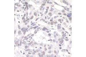 Immunohistochemistry (IHC) image for anti-DNA Kinase/phosphatase Pnk1 (PNK1) (AA 100-150) antibody (ABIN7454516) (Pnk1 antibody  (AA 100-150))