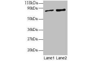 Western blot All lanes: RAB1A antibody at 2 μg/mL Lane 1: EC109 whole cell lysate Lane 2: 293T whole cell lysate Secondary Goat polyclonal to rabbit IgG at 1/15000 dilution Predicted band size: 23, 16, 14 kDa Observed band size: 80 kDa (RAB1A antibody  (AA 2-205))
