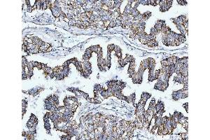 IHC analysis of TOMM40 using anti-TOMM40 antibody (ABIN7599738).