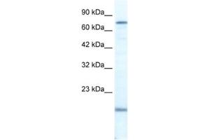 Western Blotting (WB) image for anti-PiggyBac Transposable Element Derived 3 (PGBD3) antibody (ABIN2461365) (PGBD3 antibody)