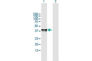 Western Blot analysis of PHF20L1 expression in transfected 293T cell line by PHF20L1 MaxPab polyclonal antibody. (PHF20L1 antibody  (AA 1-285))